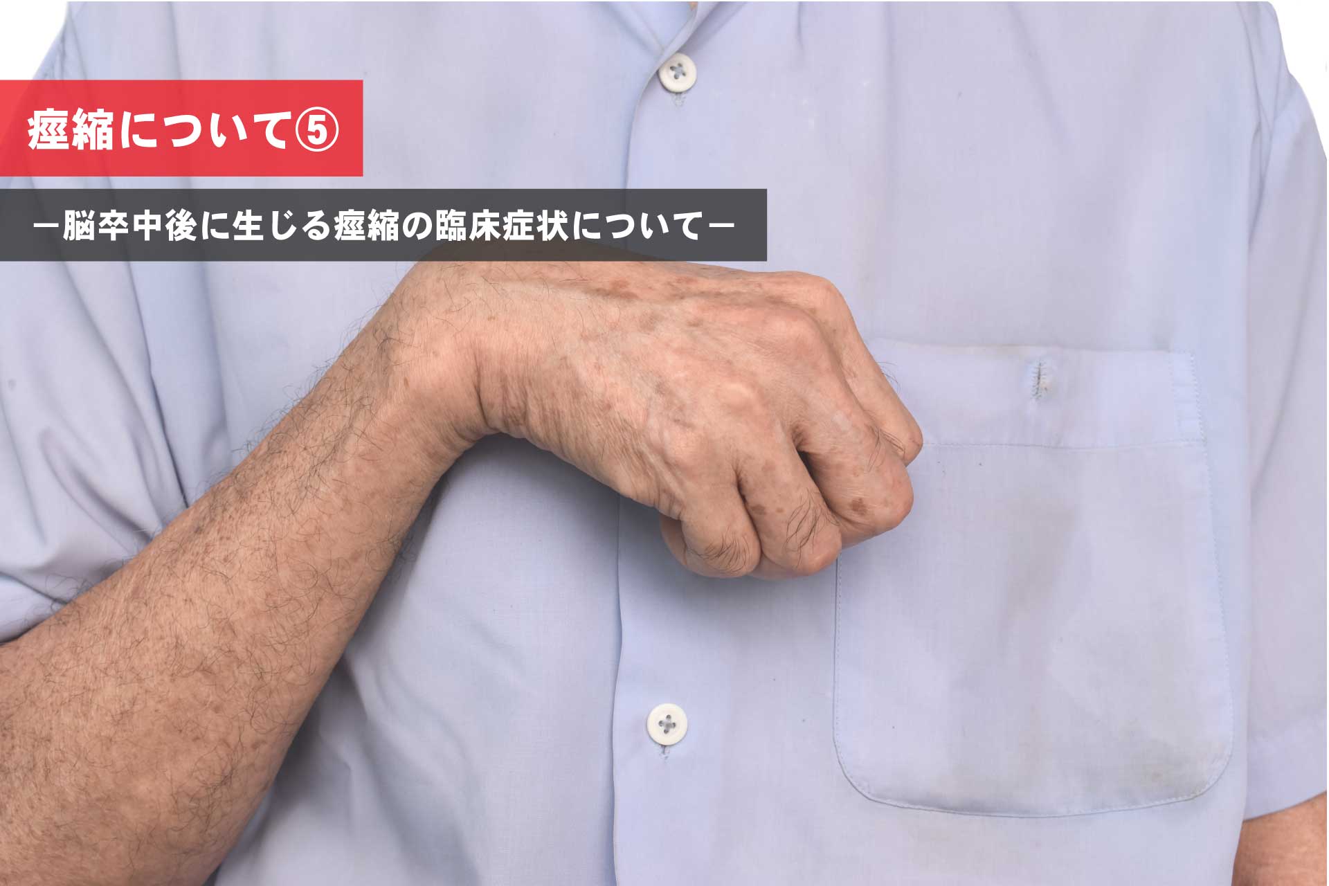 理学療法は痙縮をどのように助けますか?